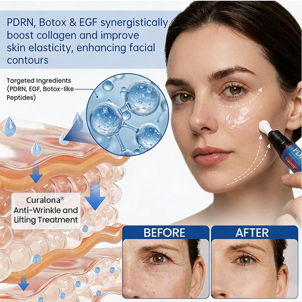 🥈🧡🧶Curalona® Botox & PDRN Anti-Wrinkle Shot – Lift & Firming Cream