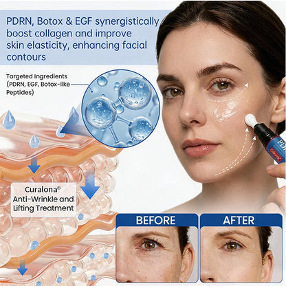 🥈🧡🧶Curalona® Botox & PDRN Anti-Wrinkle Shot – Lift & Firming Cream