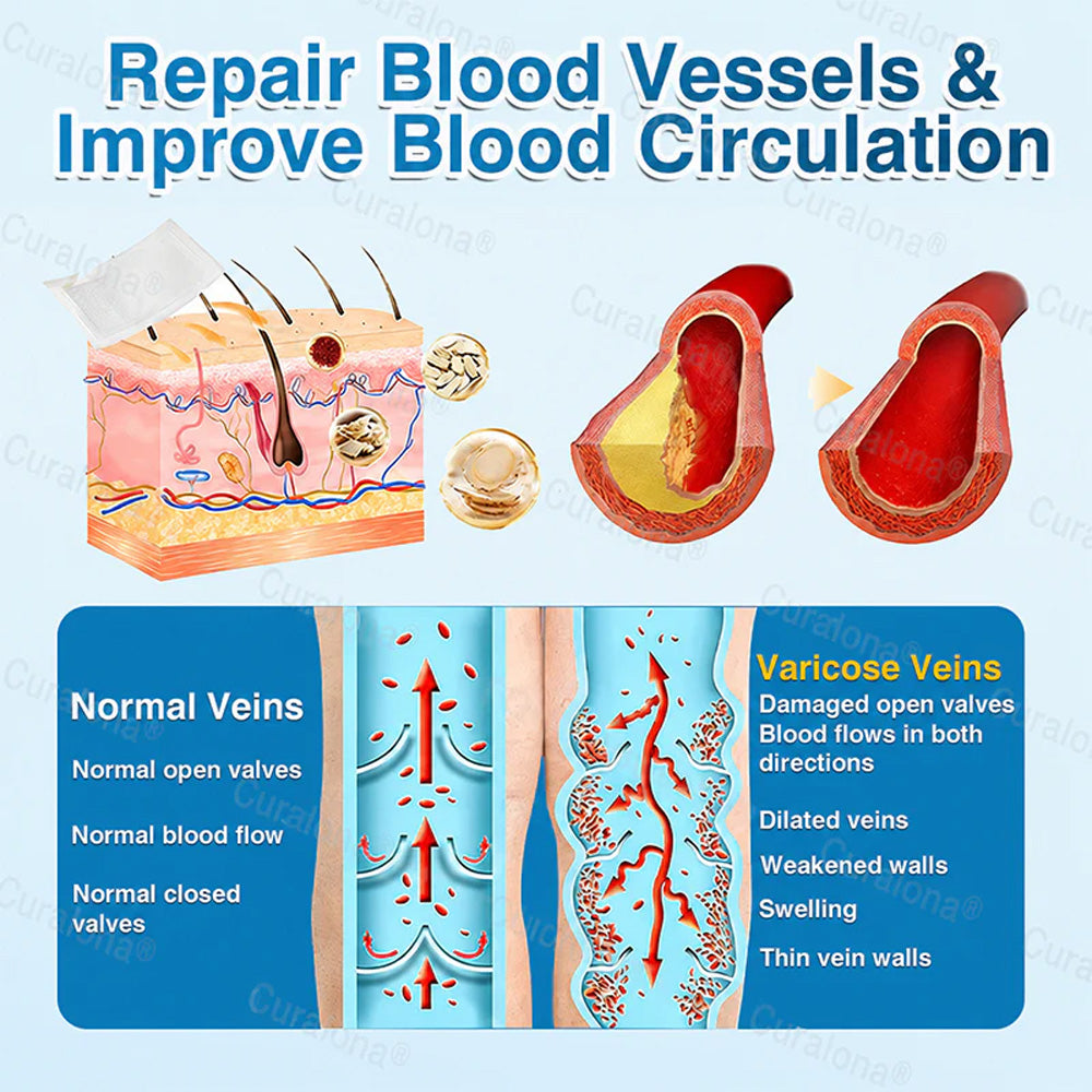 🇨🇦🏆✅️🏃Curalona® VeinRepair Microneedle Patch Roll⚡Instant Relief, Long-Term Results