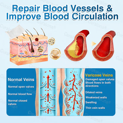 🇨🇦🏆✅️🏃Curalona® VeinRepair Microneedle Patch Roll⚡Instant Relief, Long-Term Results