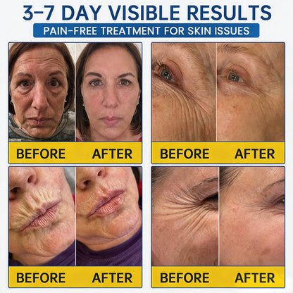 🥈🧡🧶Curalona® Botox & PDRN Anti-Wrinkle Shot – Lift & Firming Cream