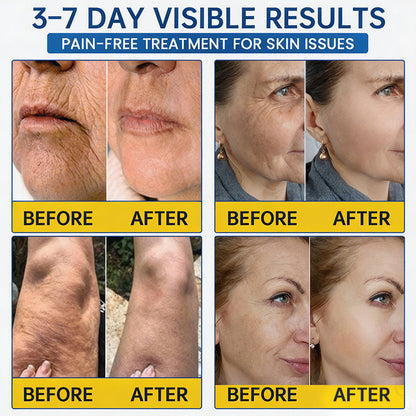 🥈🧡🧶Curalona® Botox & PDRN Anti-Wrinkle Shot – Lift & Firming Cream