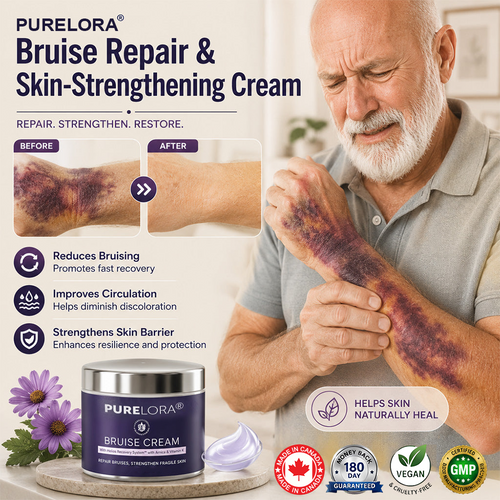 💥Over 100,000 units sold💕 - PURELORA® cream to repair bruises and strengthen the skin