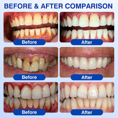 🇨🇦🦷Curalona® GumRevive Periodontal Repair Gel (For Bleeding Gums, Gum Recession & Loose Teeth)