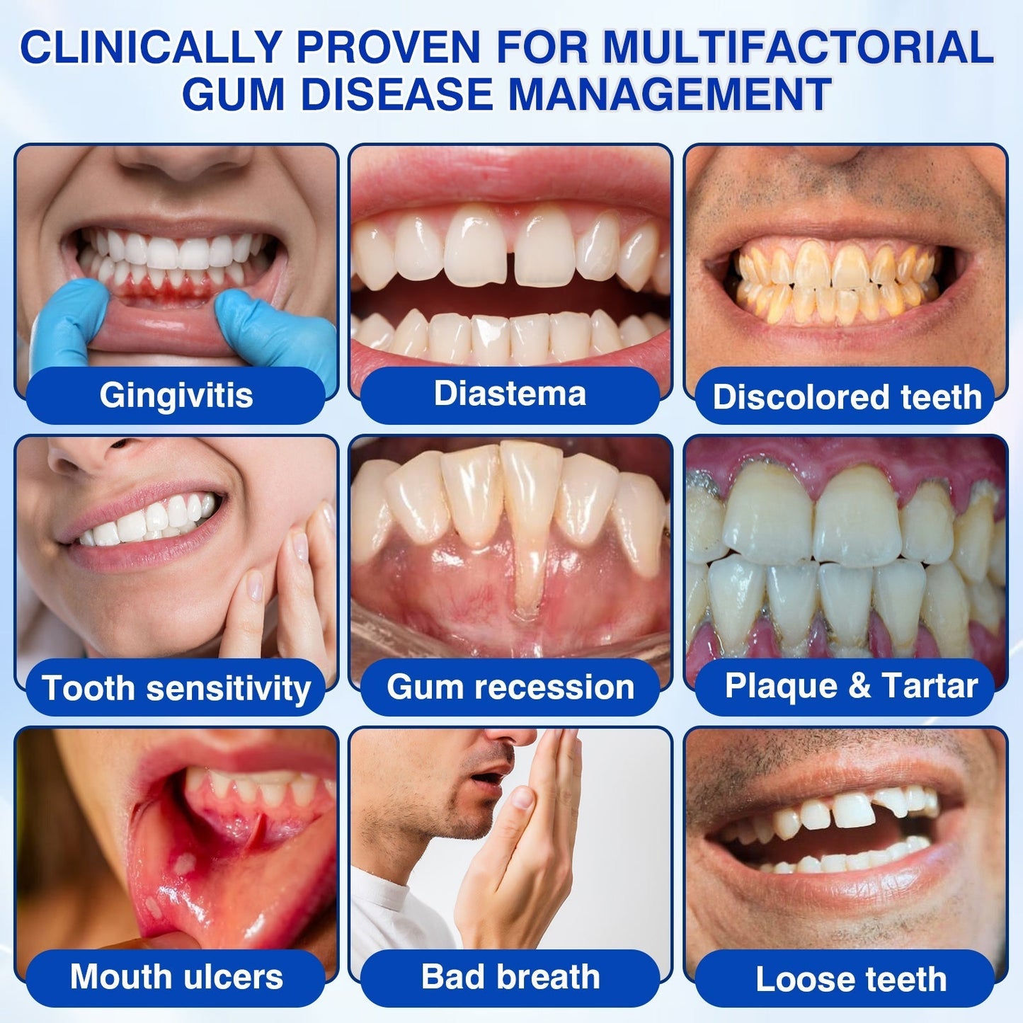 🇨🇦🦷Curalona® GumRevive Periodontal Repair Gel (For Bleeding Gums, Gum Recession & Loose Teeth)
