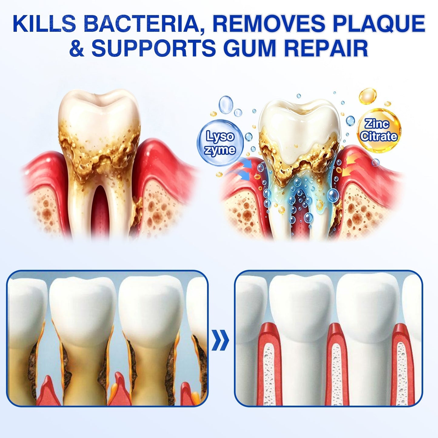 🇨🇦🦷Curalona® GumRevive Periodontal Repair Gel (For Bleeding Gums, Gum Recession & Loose Teeth)