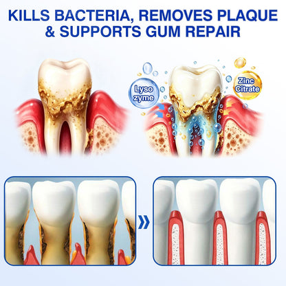 🇨🇦🦷Curalona® GumRevive Periodontal Repair Gel (For Bleeding Gums, Gum Recession & Loose Teeth)
