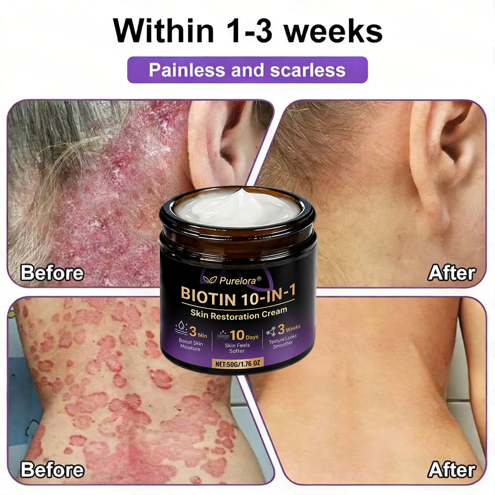 Made and Shipped from the CA 🍁 Purelora® Biotin 10-in-1 Skin Repair Cream — Last Day of Sale: 75% Off