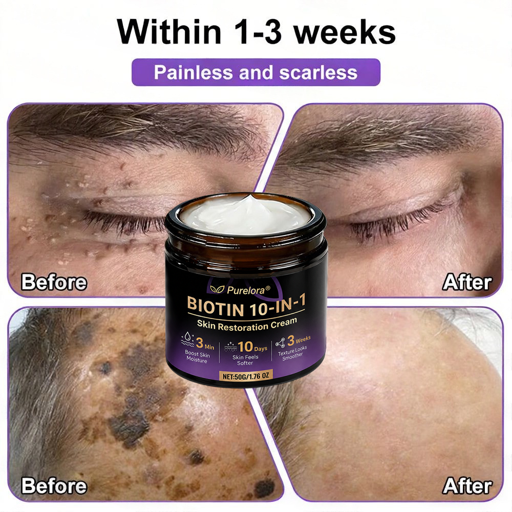 Made and Shipped from the CA 🍁 Purelora® Biotin 10-in-1 Skin Repair Cream — Last Day of Sale: 75% Off