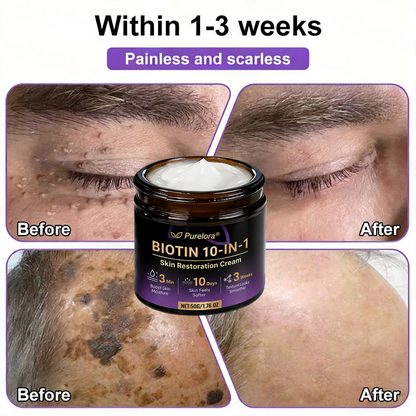 Made and Shipped from the CA 🍁 Purelora® Biotin 10-in-1 Skin Repair Cream — Last Day of Sale: 75% Off