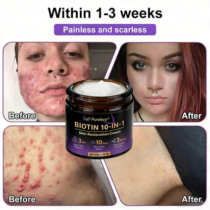 Made and Shipped from the CA 🍁 Purelora® Biotin 10-in-1 Skin Repair Cream — Last Day of Sale: 75% Off