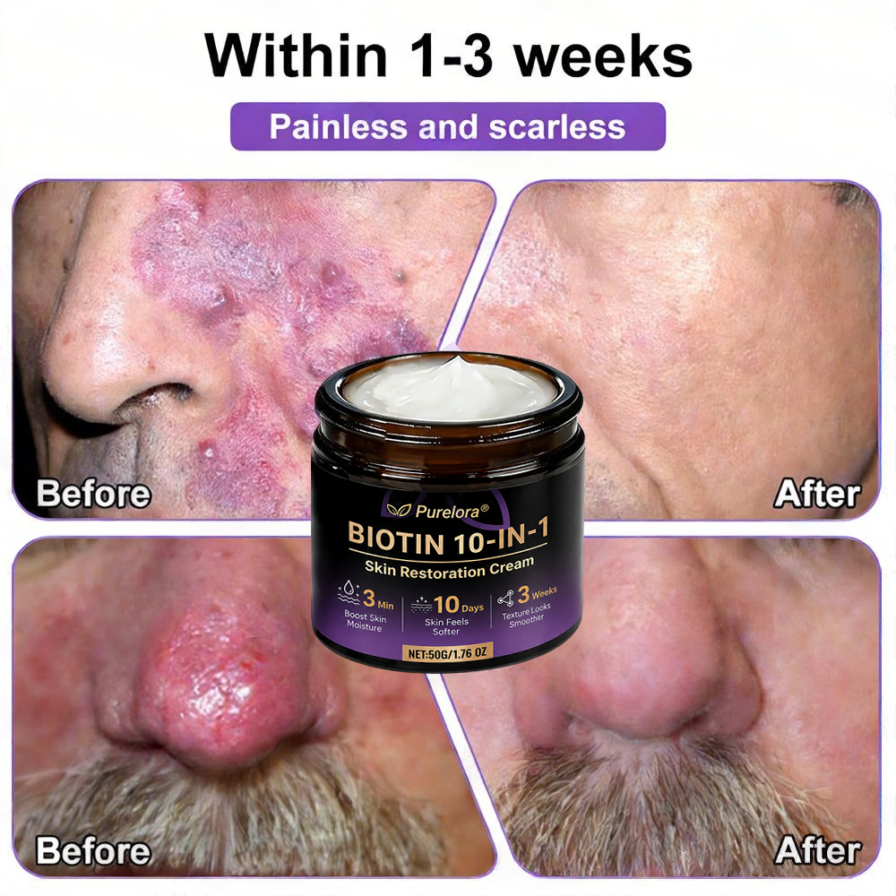 Made and Shipped from the CA 🍁 Purelora® Biotin 10-in-1 Skin Repair Cream — Last Day of Sale: 75% Off