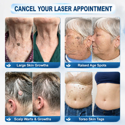 𝐏𝐔𝐑𝐄𝐋𝐎𝐑𝐀® 𝟕-𝐃𝐚𝐲 𝐒𝐤𝐢𝐧 𝐓𝐚𝐠 & 𝐒𝐩𝐨𝐭 𝐑𝐞𝐦𝐨𝐯𝐚𝐥 𝐂𝐫𝐞𝐚𝐦 (𝐏𝐚𝐢𝐧𝐥𝐞𝐬𝐬 𝐅𝐨𝐫𝐦𝐮𝐥𝐚 – 𝐍𝐨 𝐒𝐜𝐚𝐫𝐫𝐢𝐧𝐠) 🌹🌹