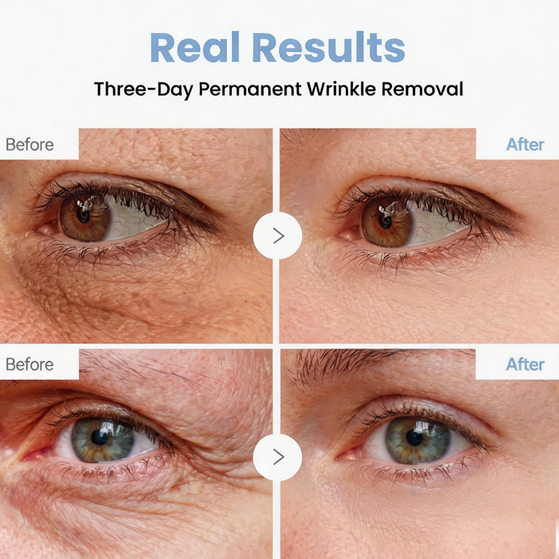 🥈🧡🧶Curalona® Botox & PDRN Anti-Wrinkle Shot – Lift & Firming Cream