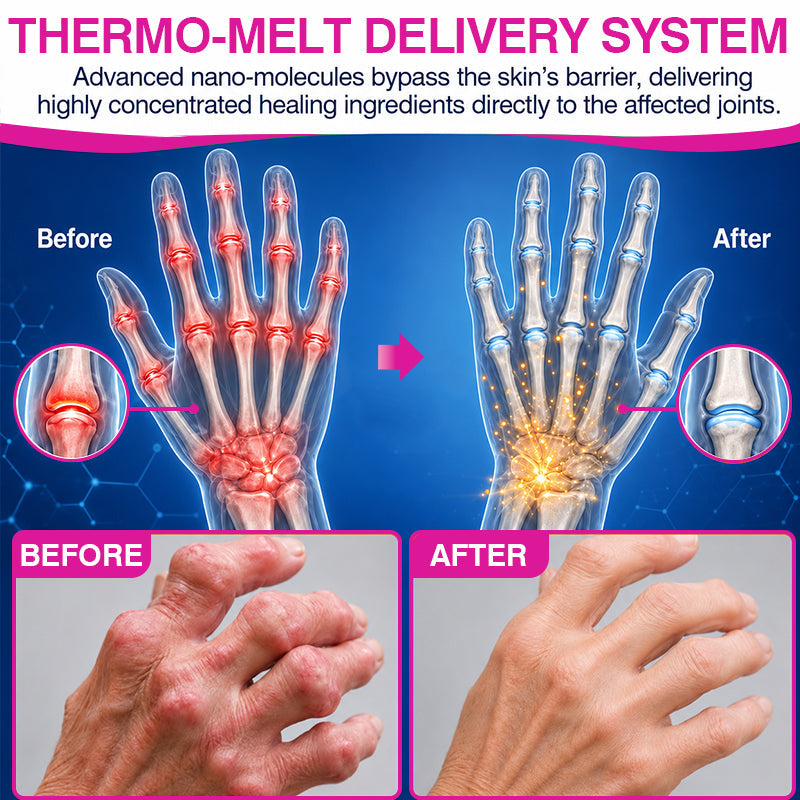 🏅✅🇬🇧 Official Store: 𝐏𝐔𝐑𝐄𝐋𝐎𝐑𝐀® Pain-Relief Bone-Healing Balm Stick(🧑‍⚕️Reducing joint swelling, pain, stiffness, redness, warmth, soreness, and joint fatigue)