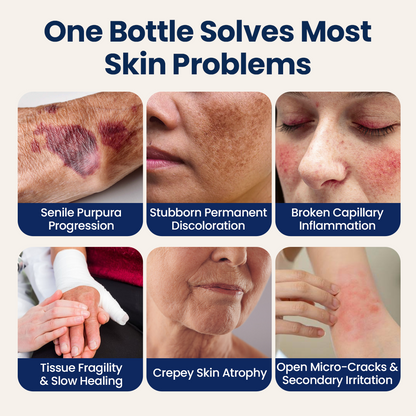 Purelora® ResiliVeil Bruise Appearance Barrier Care Cream