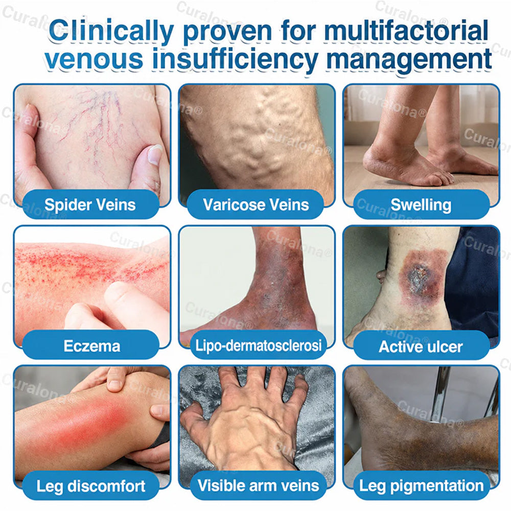 🇨🇦🏆✅️🏃Curalona® VeinRepair Microneedle Patch Roll⚡Instant Relief, Long-Term Results