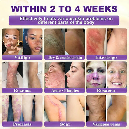 Made and Shipped from the CA 🍁 Purelora® Biotin 10-in-1 Skin Repair Cream — Last Day of Sale: 75% Off