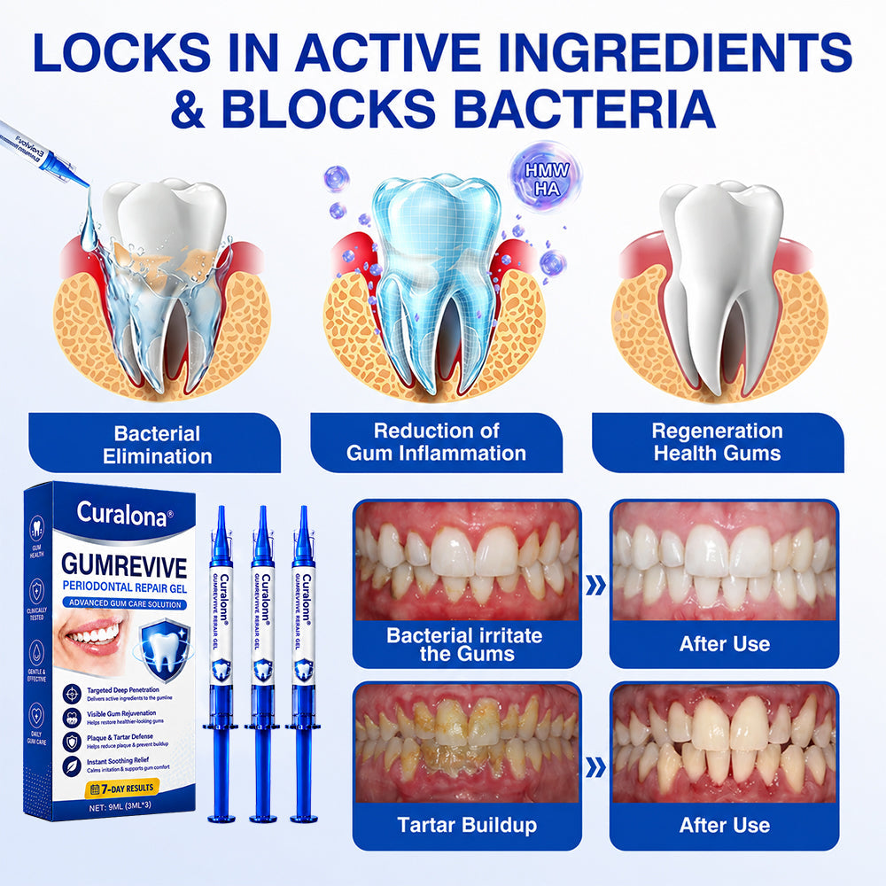 🇨🇦🦷Curalona® GumRevive Periodontal Repair Gel (For Bleeding Gums, Gum Recession & Loose Teeth)